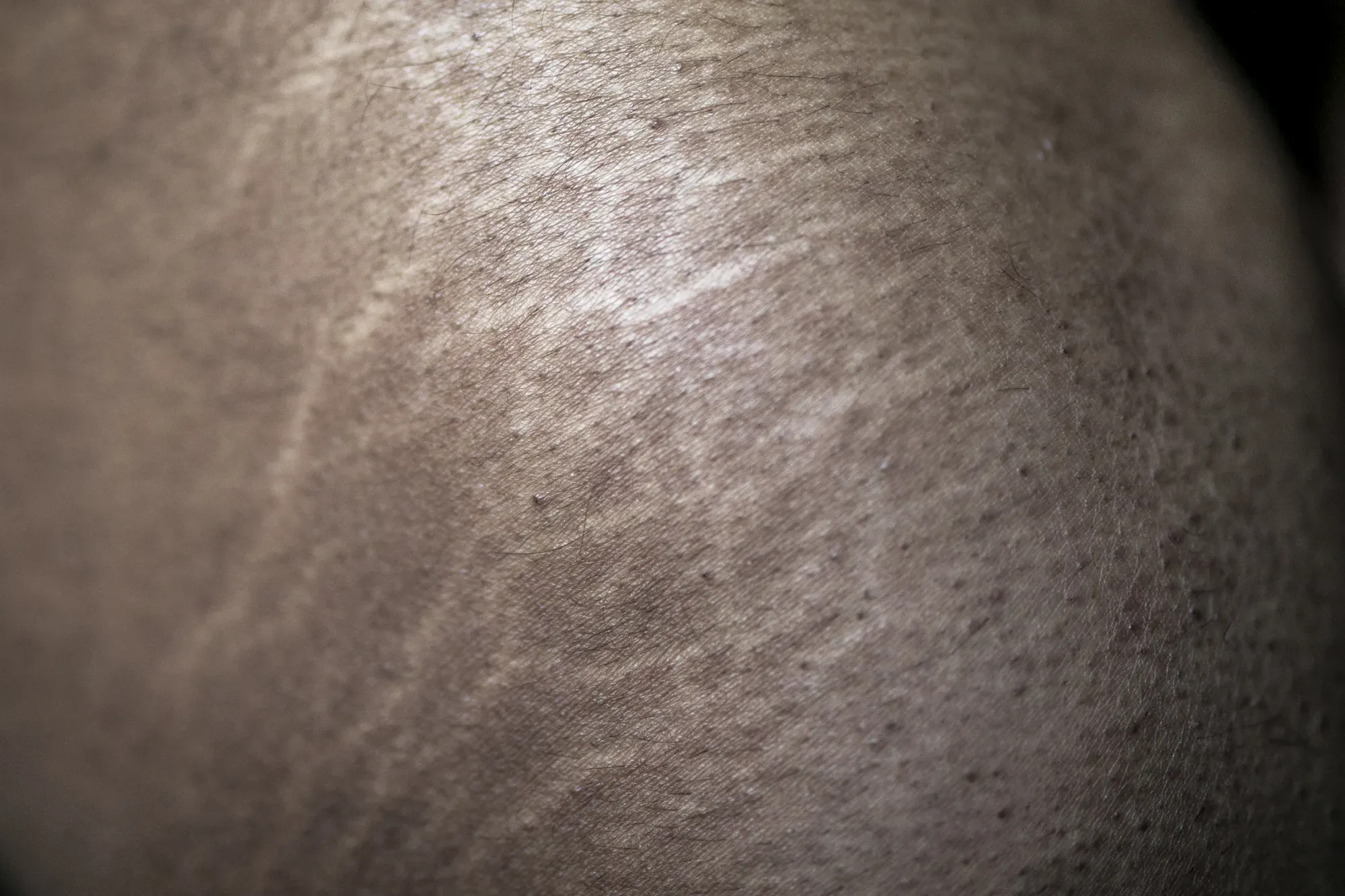 El Cuerpo Incómodo - Image 8